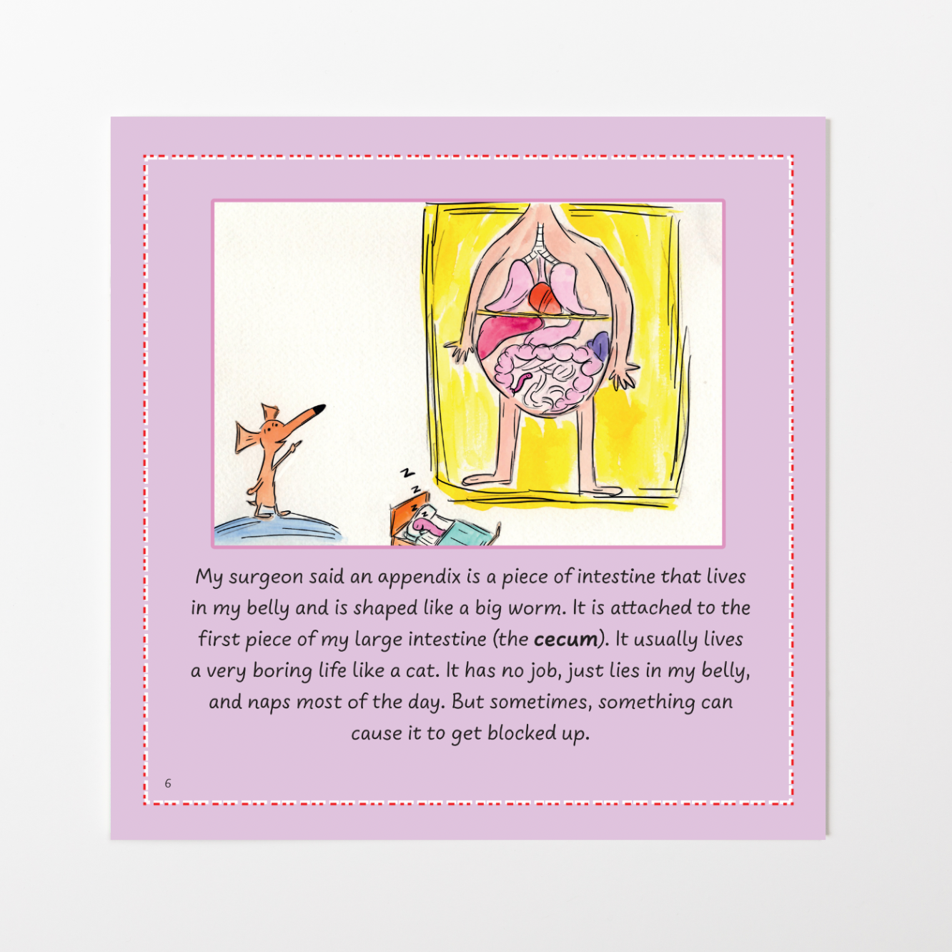 Appendicitis: One Angry Worm