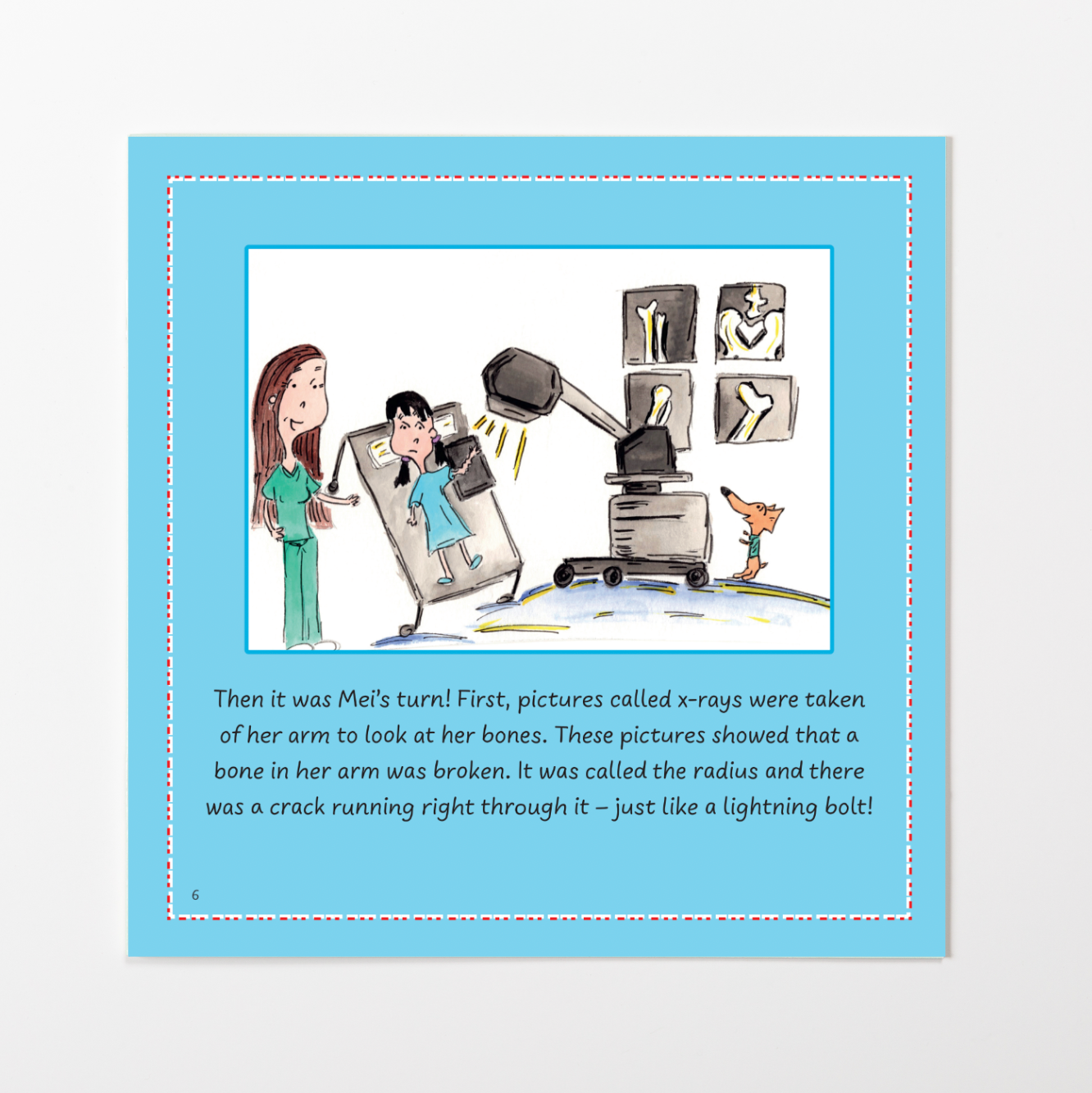 Broken Bones: Mei and the Monkey Bars