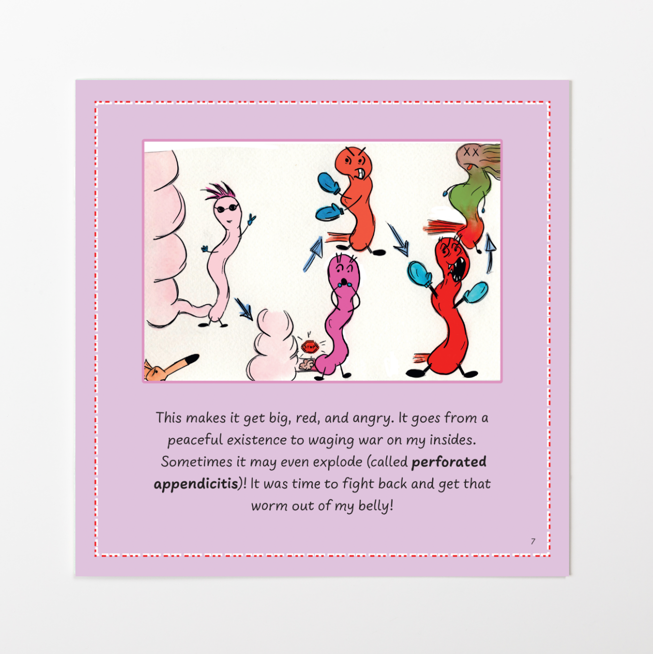 Appendicitis: One Angry Worm