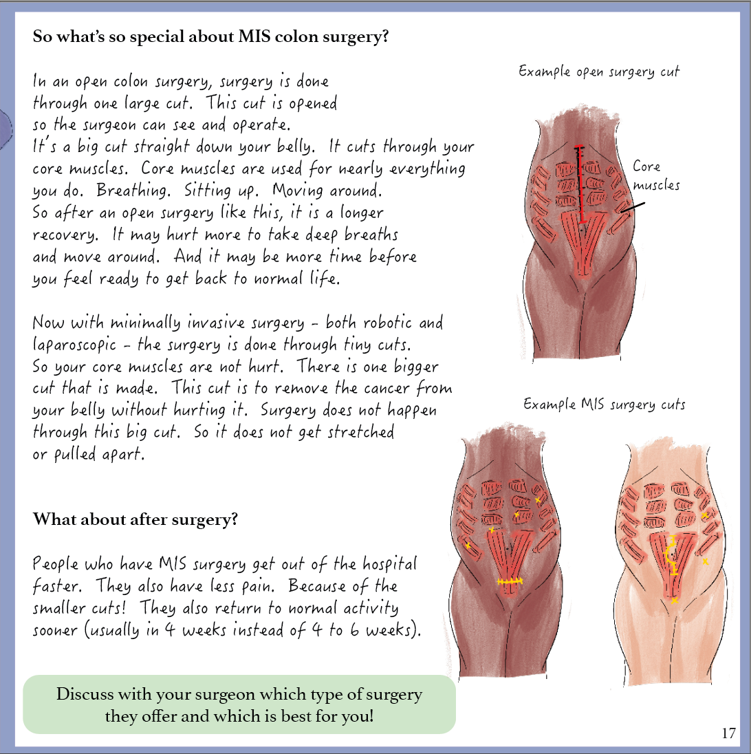 Colon Cancer: A patient-centered guide to diagnosis &amp; treatment