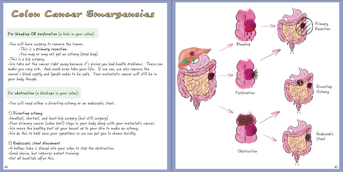 Colon Cancer: A patient-centered guide to diagnosis &amp; treatment