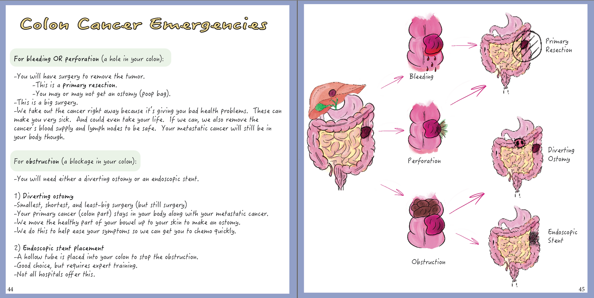 Colon Cancer: A patient-centered guide to diagnosis & treatment