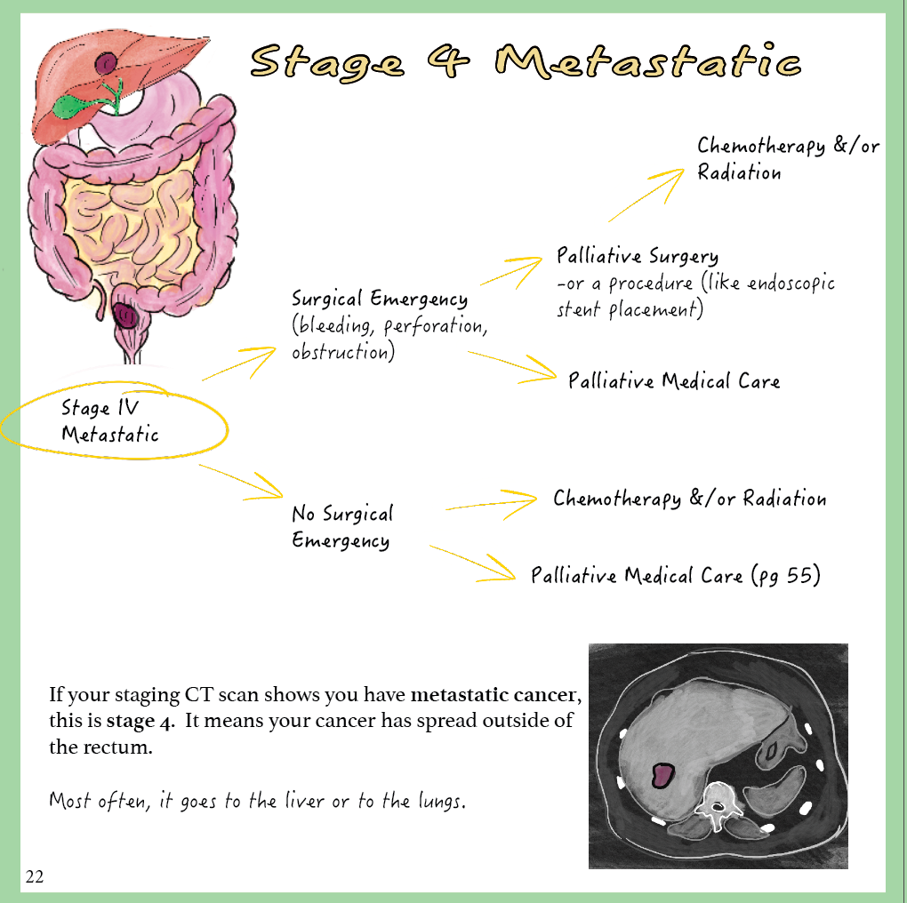 Rectal Cancer: A patient-centered guide to diagnosis &amp; treatment