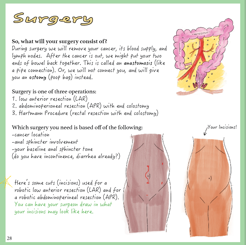 Rectal Cancer: A patient-centered guide to diagnosis &amp; treatment