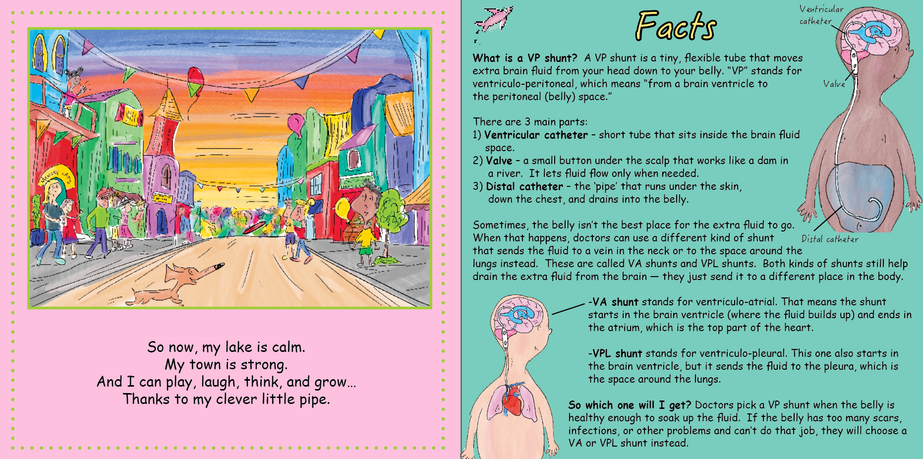 VP Shunt: My Clever Little Pipe