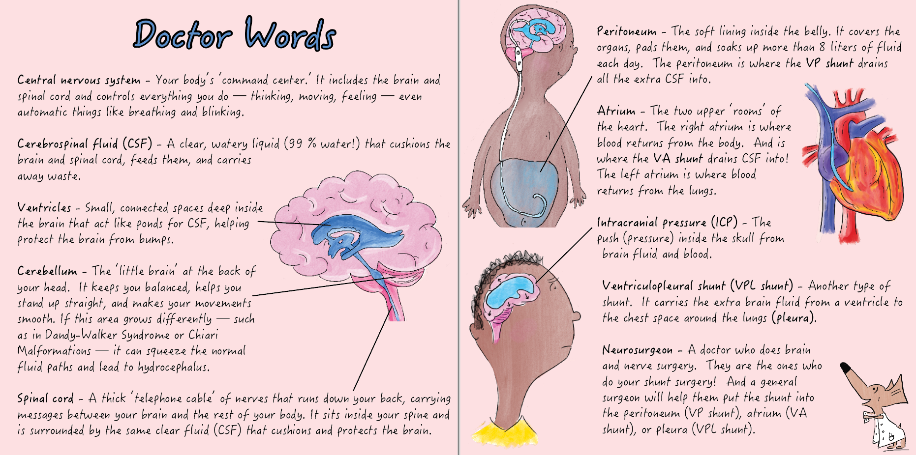 VP Shunt: My Clever Little Pipe