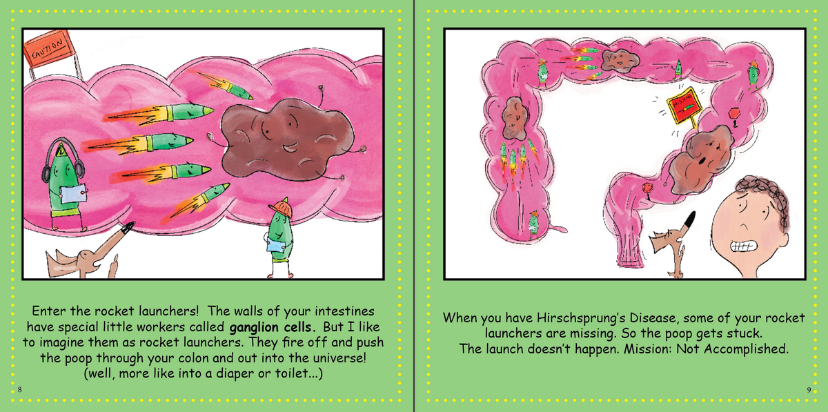 Hirschsprung&#39;s Disease: My Missing Rocket Launchers