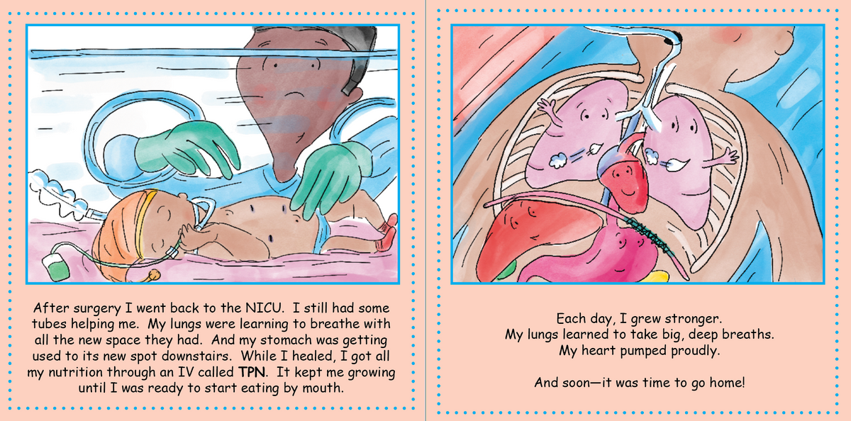 Congenital Diaphragmatic Hernia: There’s a Hole in my Floor!