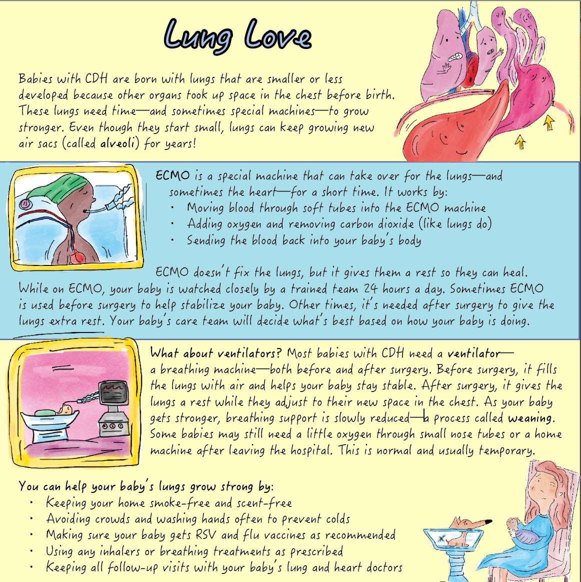 Congenital Diaphragmatic Hernia: There’s a Hole in my Floor!