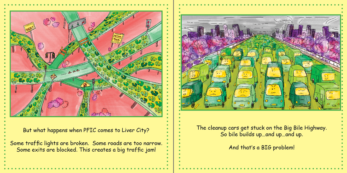 PFIC: My Liver&#39;s Traffic Jam