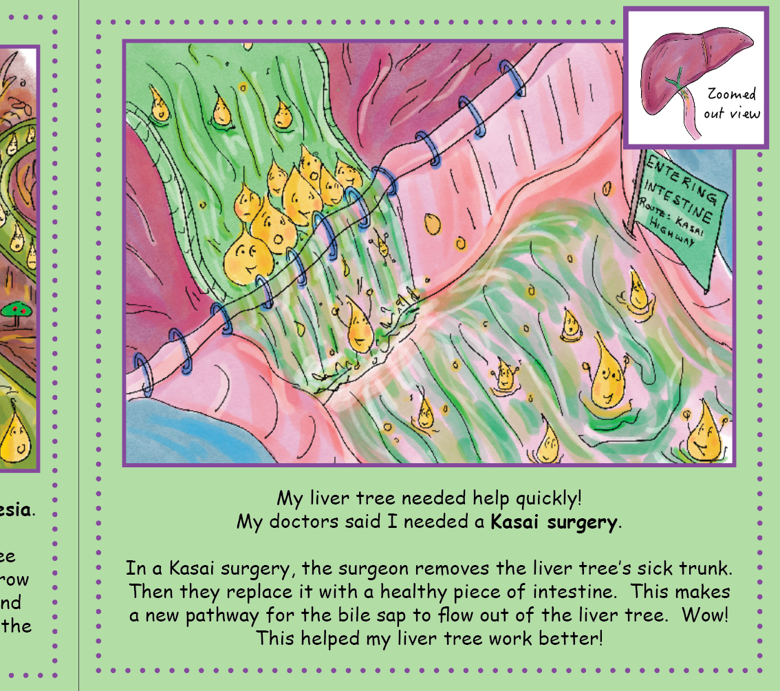 Biliary Atresia: My Troublesome Tree