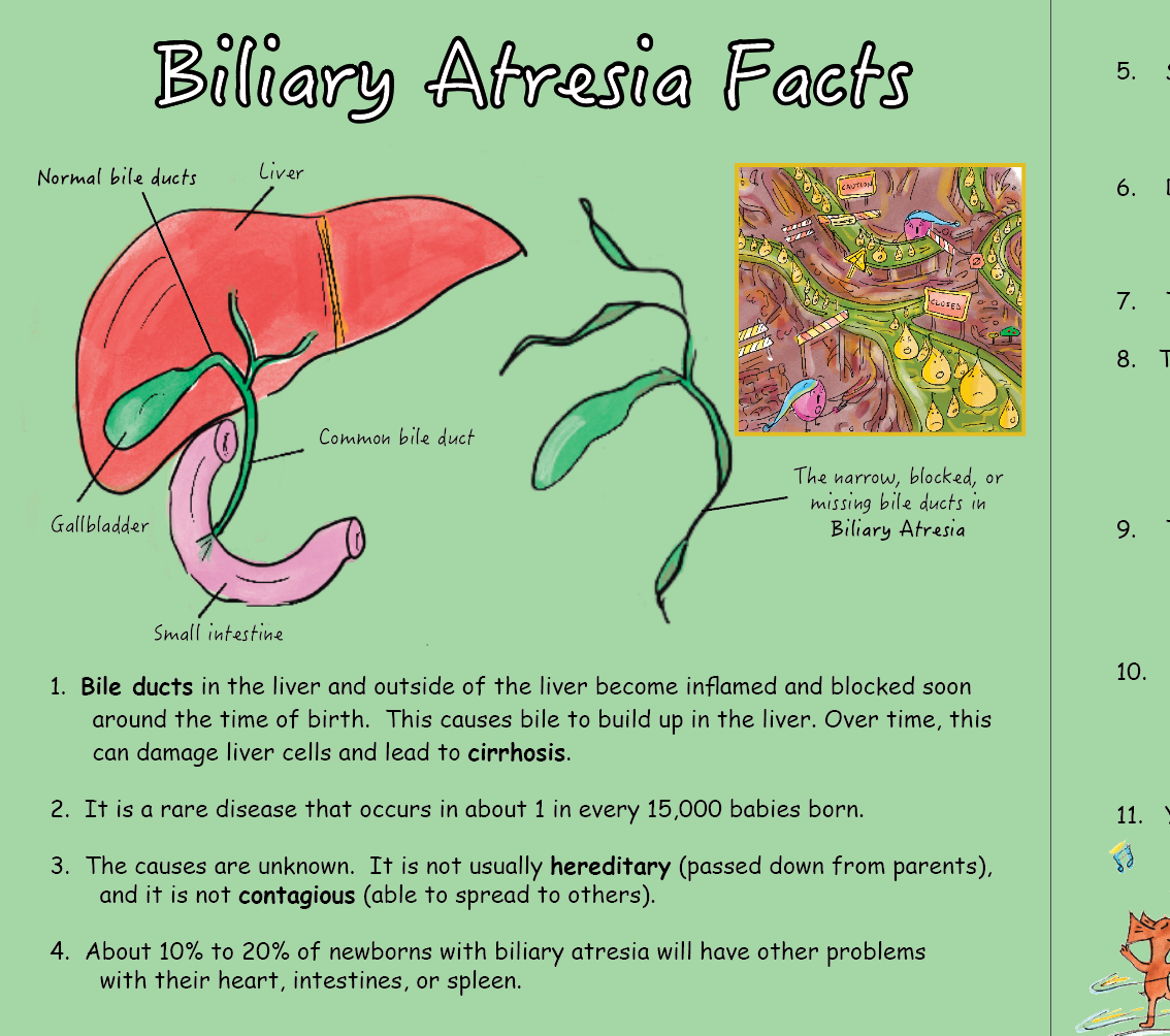 Biliary Atresia: My Troublesome Tree