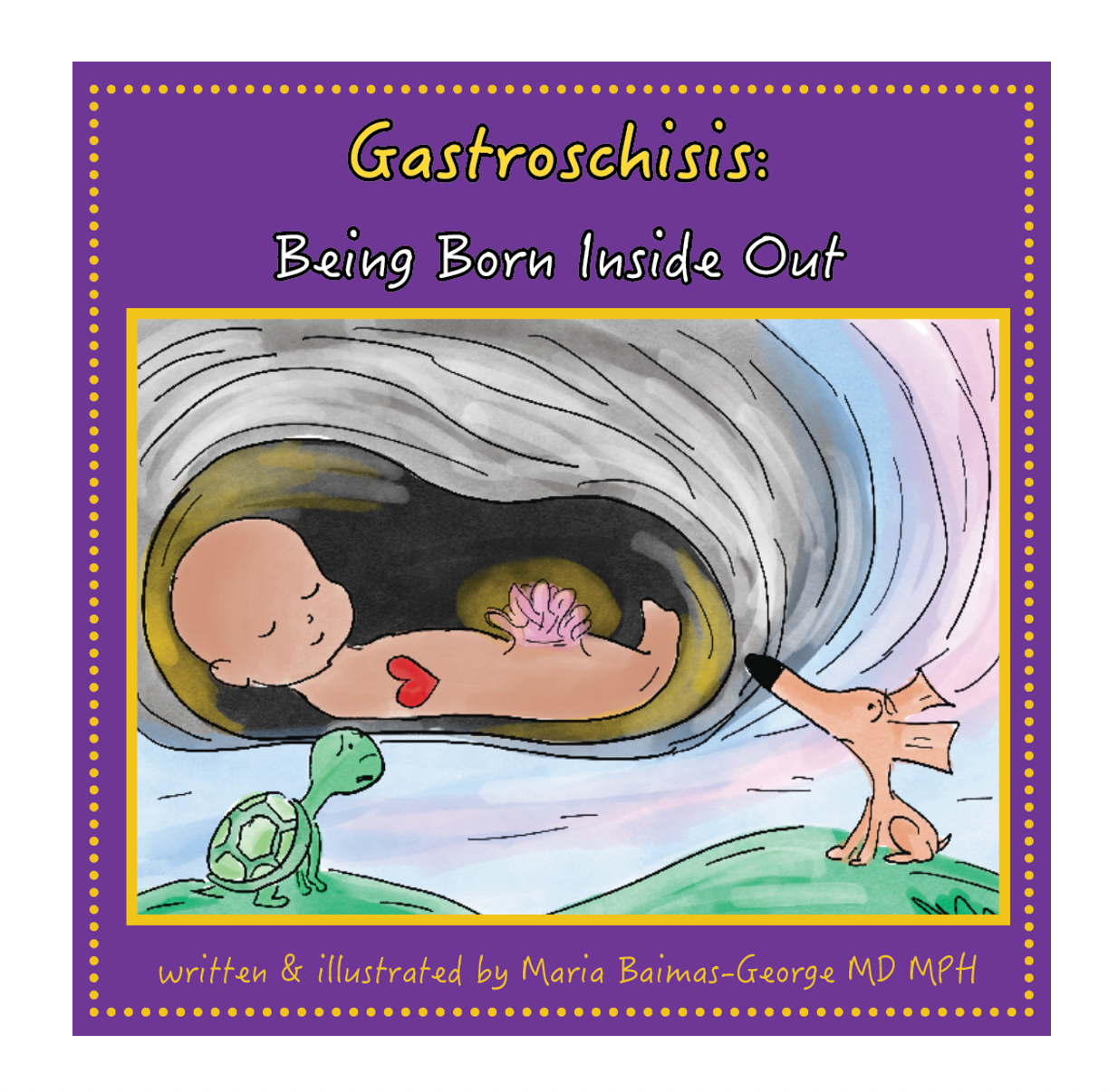Gastroschisis: Being Born Inside Out
