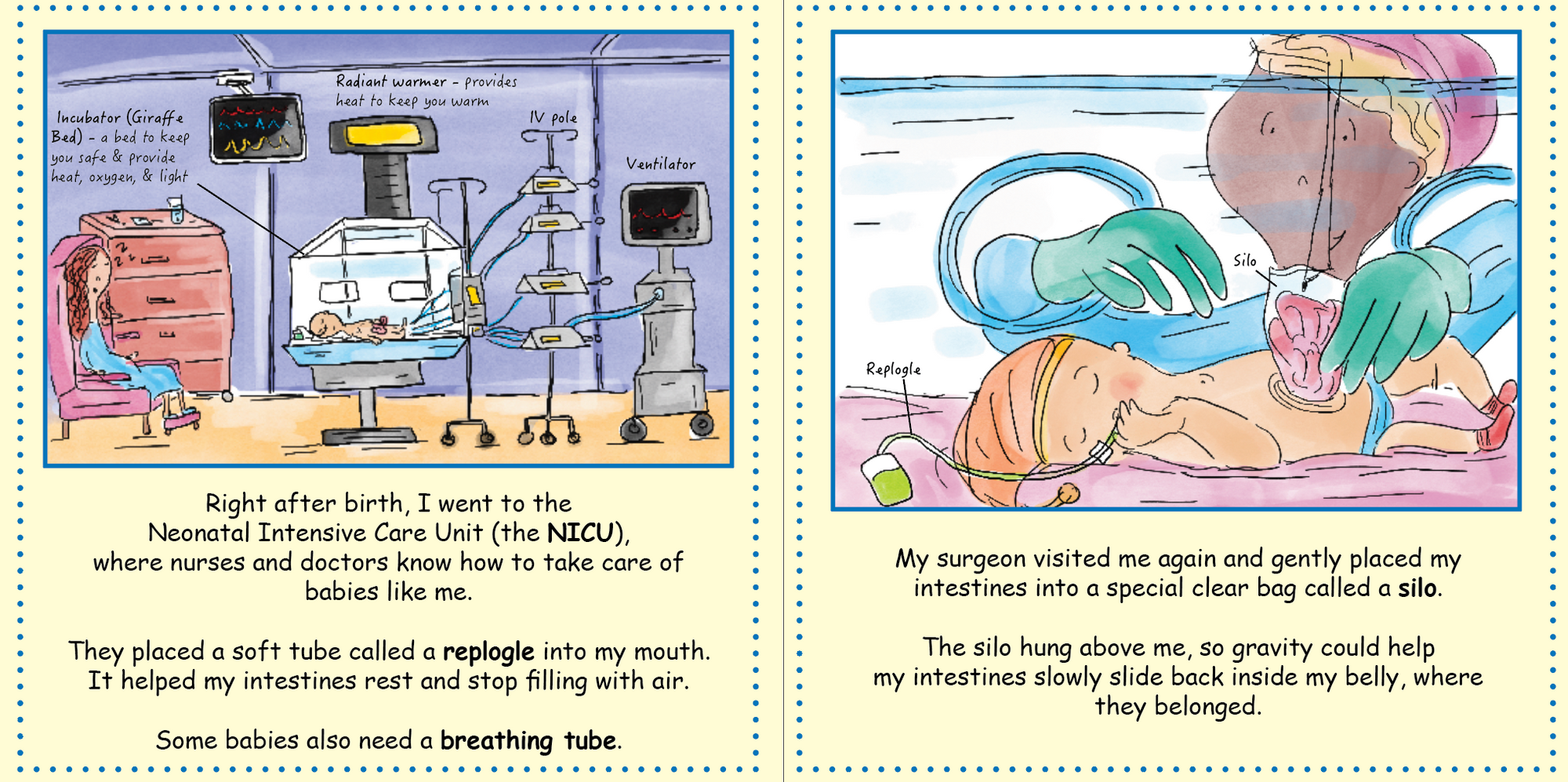 Gastroschisis: Being Born Inside Out