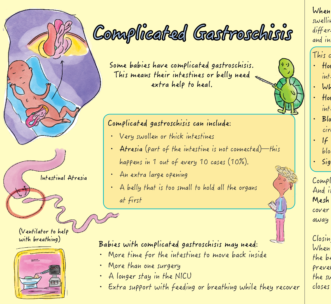 Gastroschisis: Being Born Inside Out