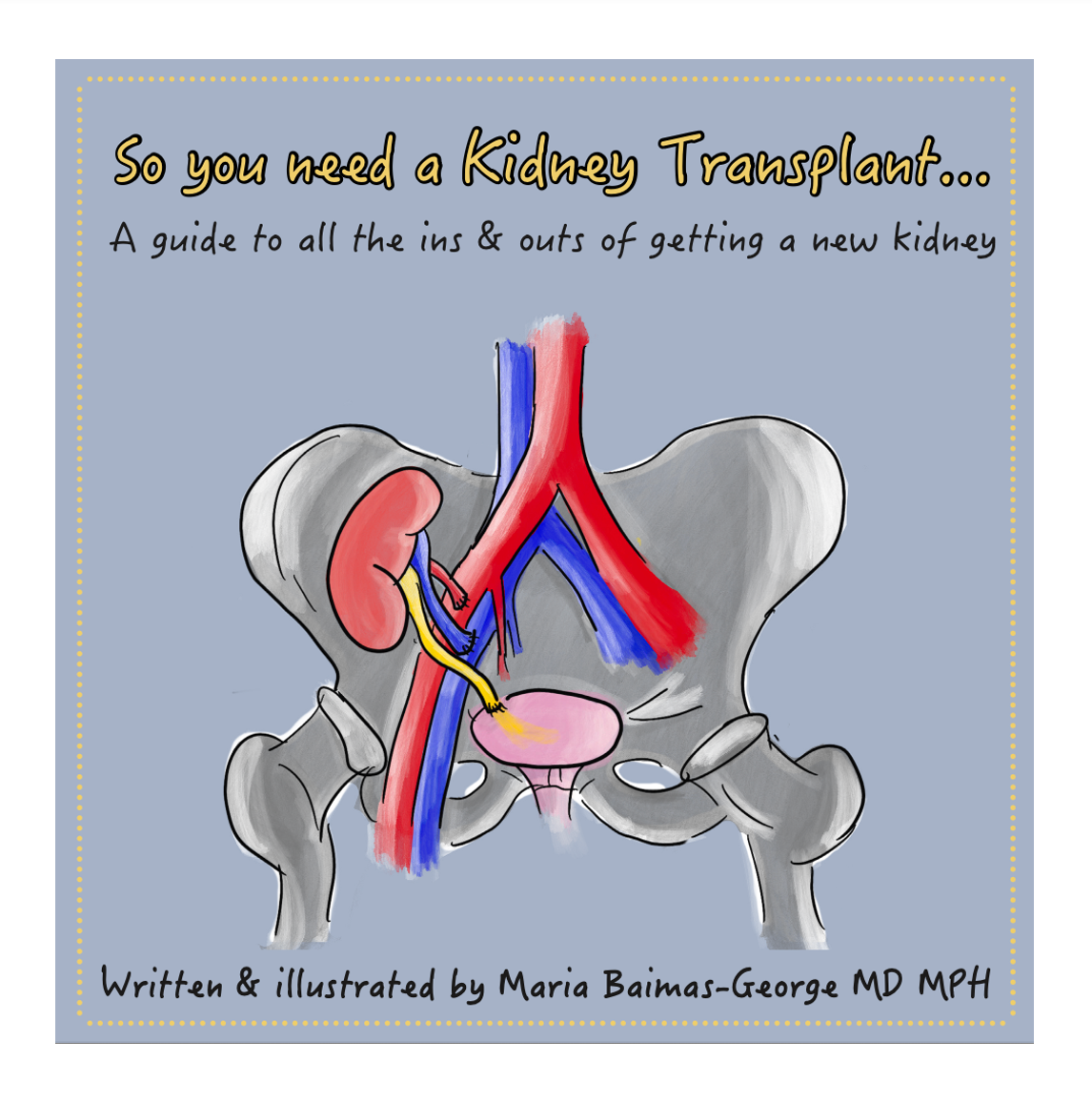 Digital PDF Edition—So you need a Kidney Transplant...A guide to all the ins & outs of getting a new kidney
