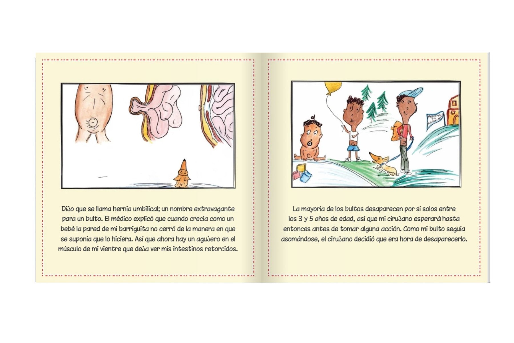 Umbilical Hernia: Buhbye Bump (Spanish Version) - Strength of My Scars