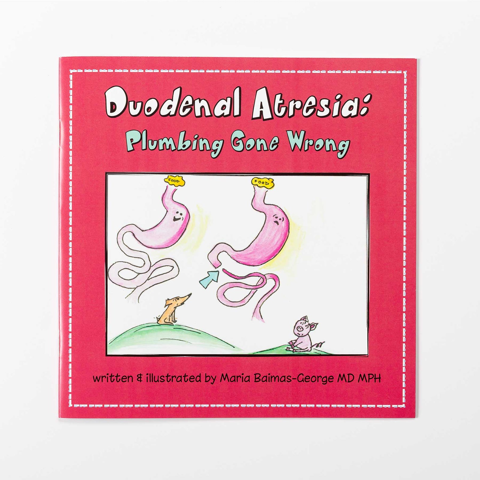 Duodenal Atresia: Plumbing Gone Wrong - Strength of My Scars