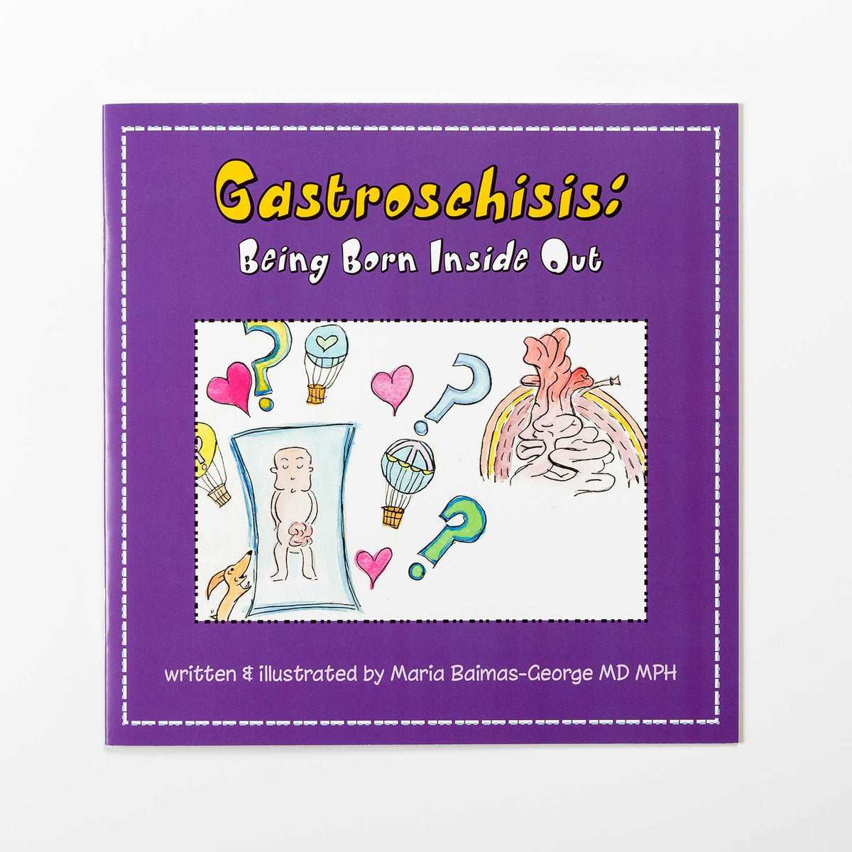 Gastroschisis: Being Born Inside Out - Strength of My Scars